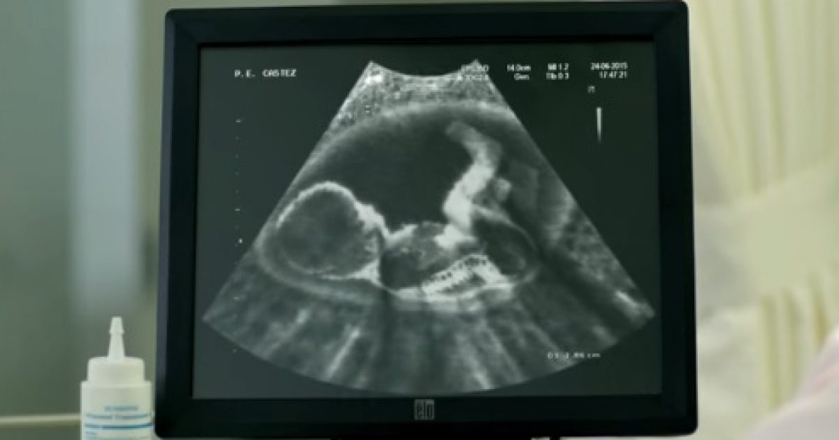 doritos ultrasound